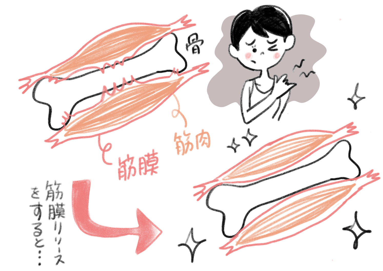 筋肉と筋膜